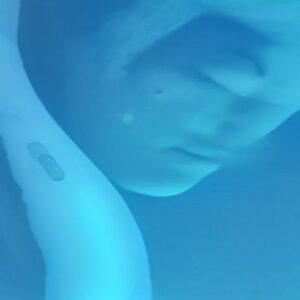 Best AI Wound Care Tools for Home Health Nurses 2026: Swift vs Net Health - ailearningguides.com